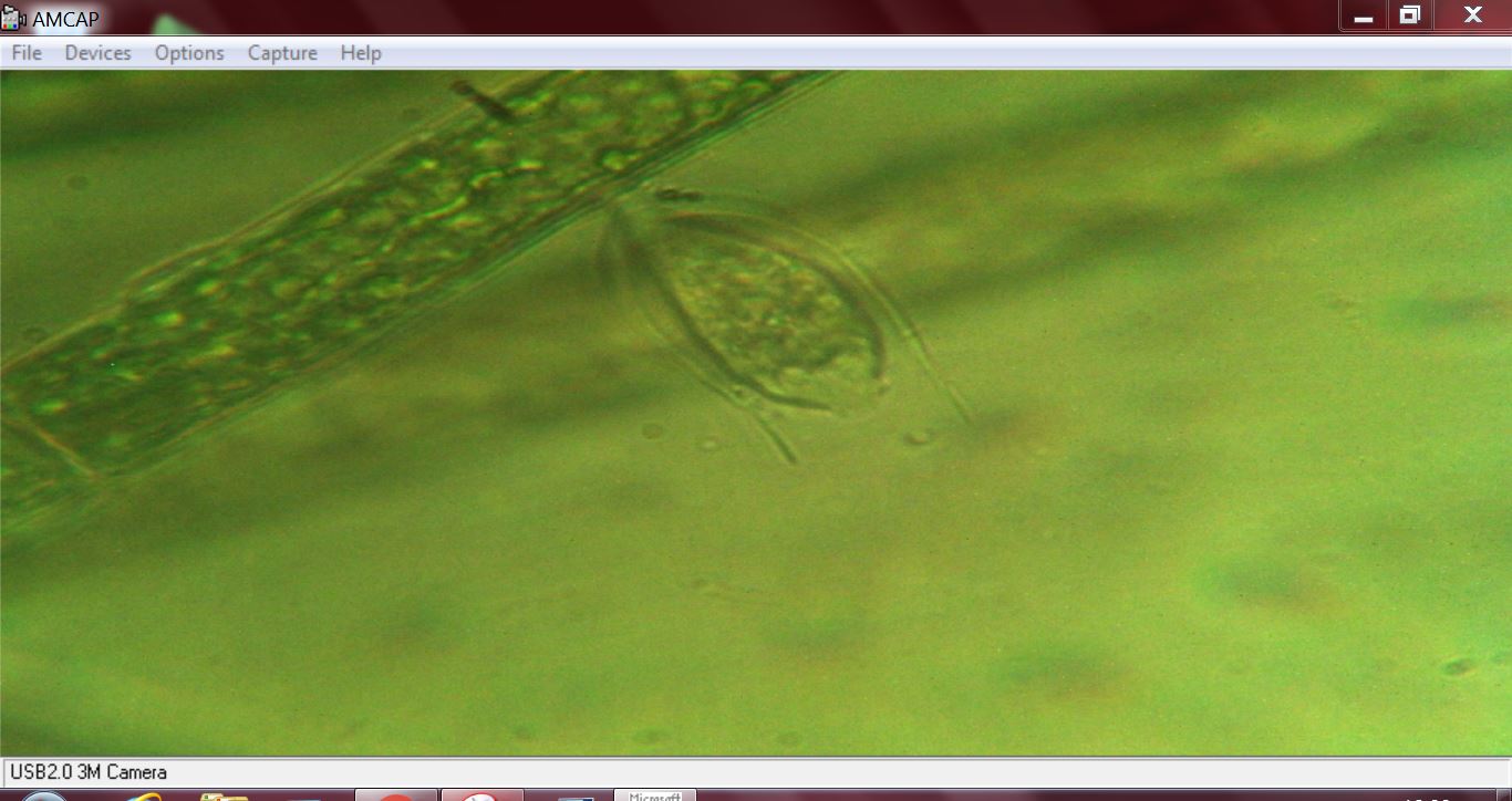 chi � questa vorticella con guscio?